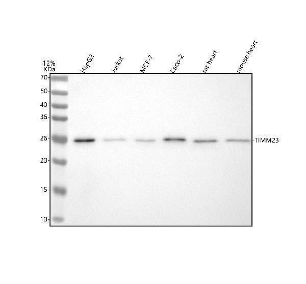 Anti-TIM23/TIMM23 Antibody Picoband® Boster Bio