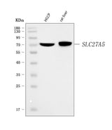 Anti-BAL/SLC27A5 Antibody Picoband® Boster Bio