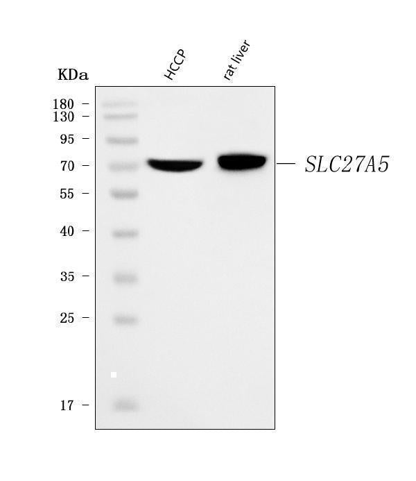 Anti-BAL/SLC27A5 Antibody Picoband® Boster Bio