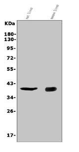 Anti-CD72 Antibody Picoband® Boster Bio