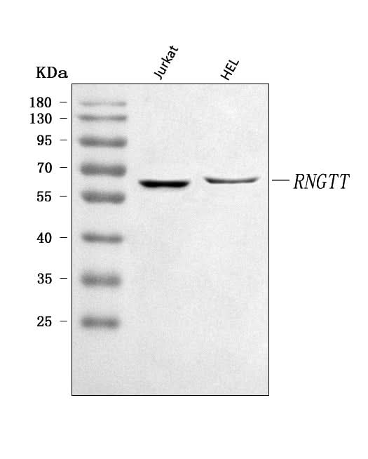 Anti-RNGTT Antibody Picoband® Boster Bio