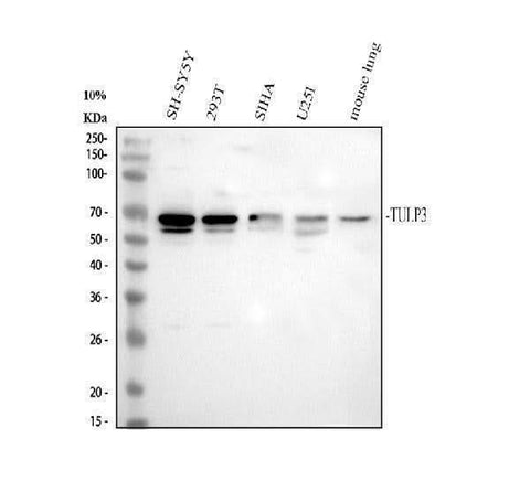Anti-TULP3 Antibody Picoband® Boster Bio