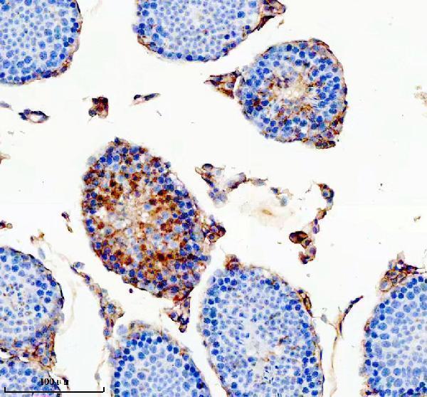 Anti-ODAM Antibody Boster Bio