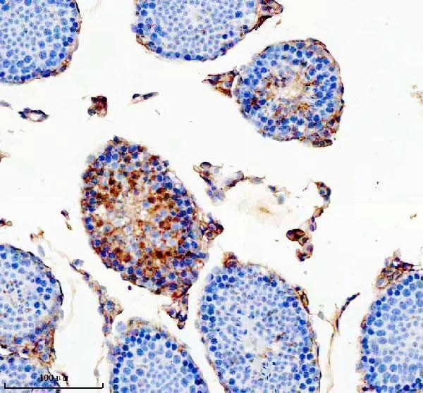 Anti-ODAM Antibody Boster Bio