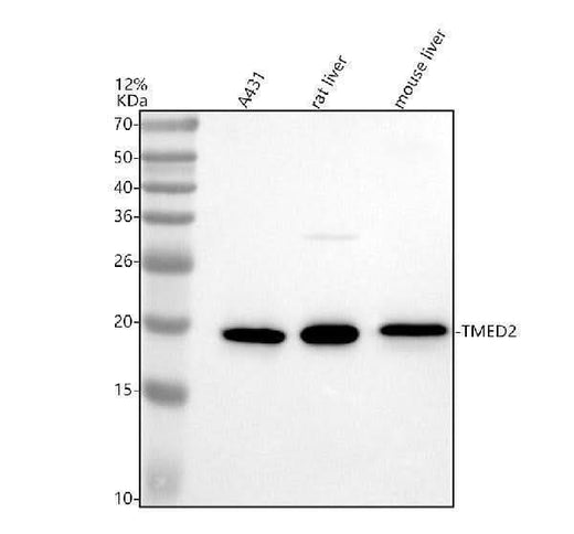 Anti-TMED2 Antibody Picoband® Boster Bio