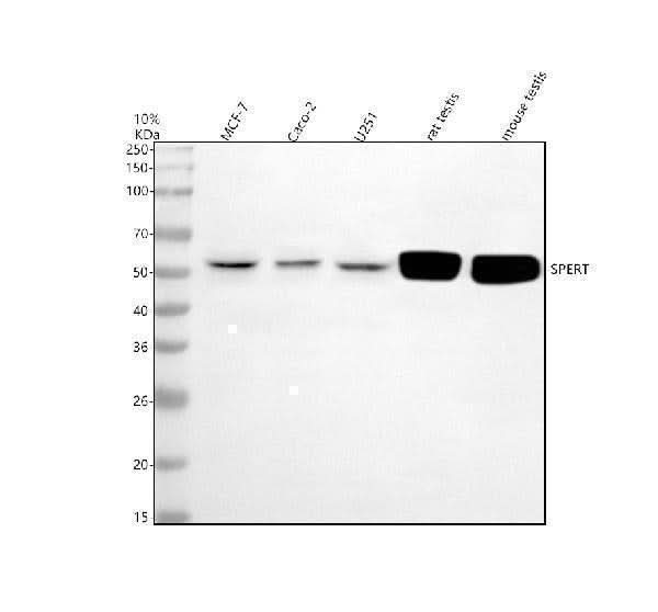 Anti-CBY2 Antibody Picoband® Boster Bio