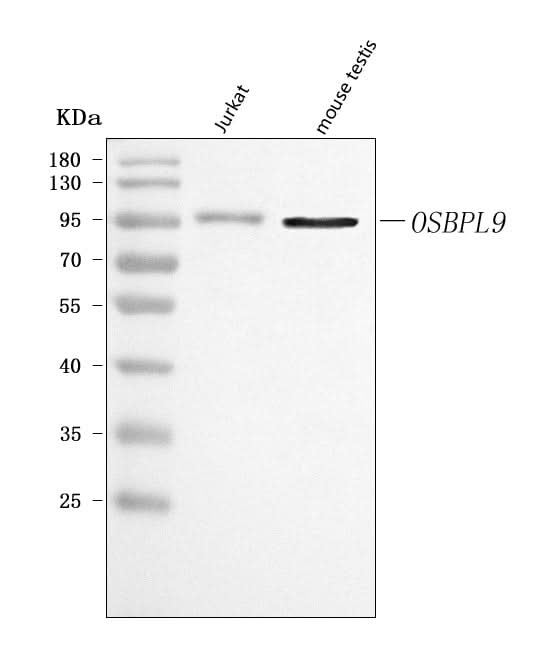 Anti-OSBPL9 Antibody Picoband® Boster Bio