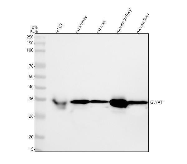 Anti-GLYAT Antibody Picoband® Boster Bio