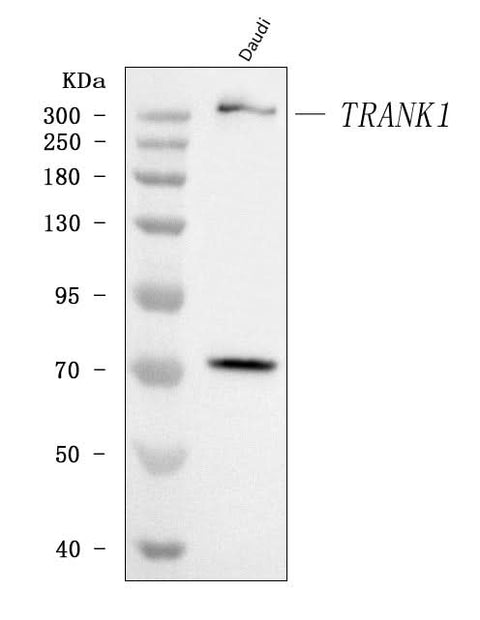 Anti-TRANK1 Antibody Picoband® Boster Bio