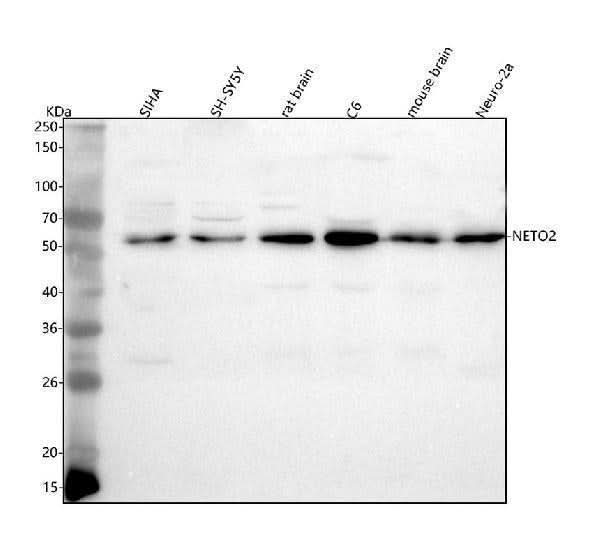 Anti-NETO2 Antibody Picoband® Boster Bio
