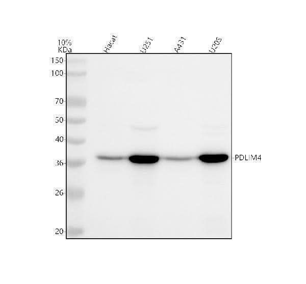 Anti-PDLIM4 Antibody Picoband® Boster Bio