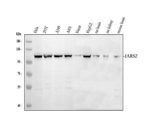 Anti-IARS2 Antibody Picoband® Boster Bio