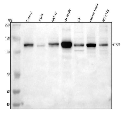 Anti-STK31 Antibody Picoband® Boster Bio