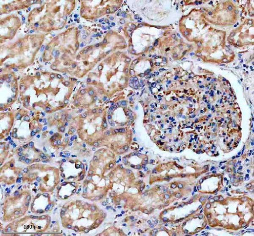 Anti-ANT4/SLC25A31 Antibody Boster Bio