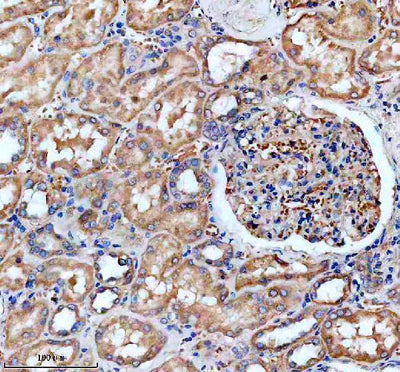 Anti-ANT4/SLC25A31 Antibody Boster Bio