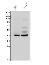 Anti-P2Y14/P2ry14 Antibody Picoband® Boster Bio