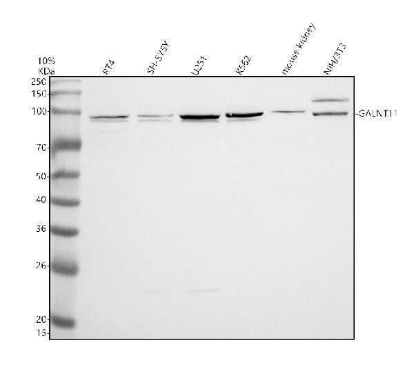 Anti-GALNT11 Antibody Picoband® Boster Bio