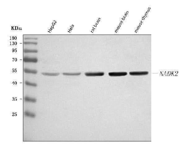 Anti-C5orf33/NADK2 Antibody Picoband® Boster Bio