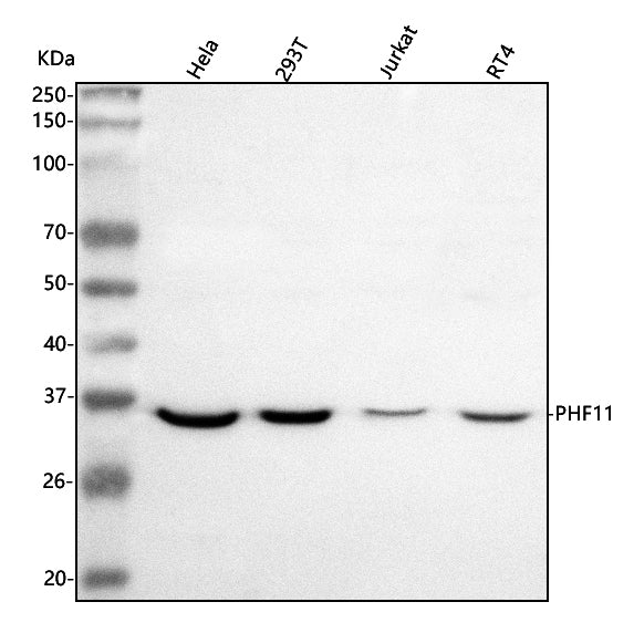 Anti-PHF11 Antibody Picoband® Boster Bio