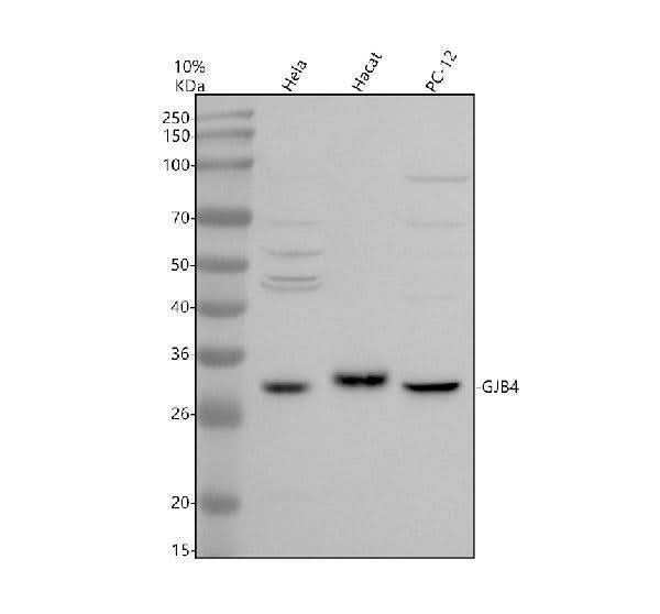 Anti-GJB4 Antibody Picoband® Boster Bio