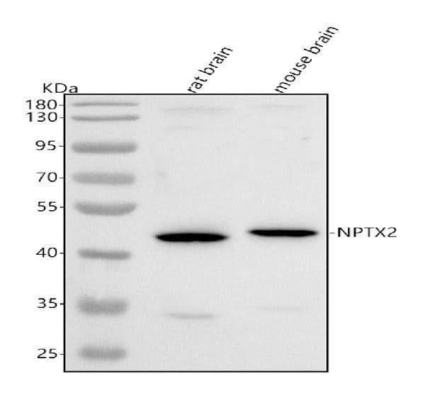 Anti-NPTX2 Antibody Picoband® Boster Bio