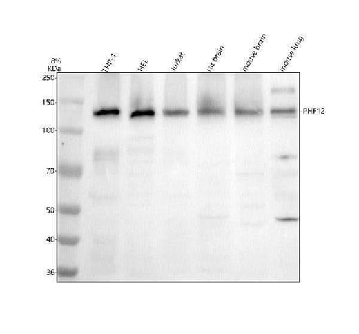 Anti-PHF12 Antibody Picoband® Boster Bio