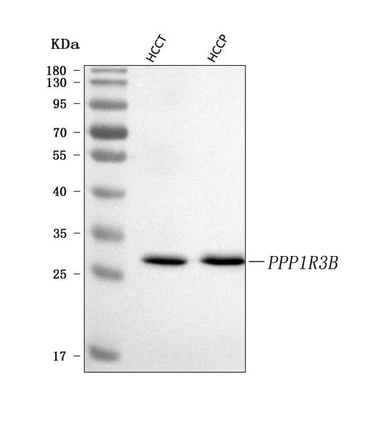 Anti-PPP1R3B Antibody Picoband® Boster Bio