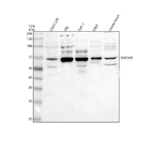 Anti-TOP1MT Antibody Picoband® Boster Bio