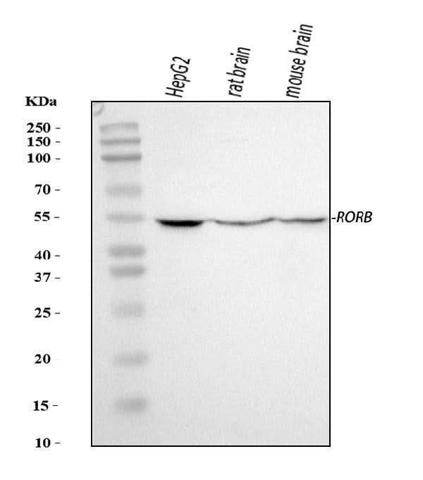 Anti-ROR beta/RORB Antibody Picoband® Boster Bio