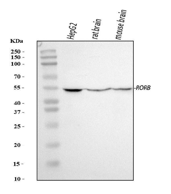 Anti-ROR beta/RORB Antibody Picoband® Boster Bio