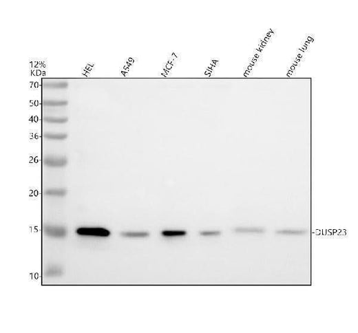 Anti-ENDOD1 Antibody Picoband® Boster Bio