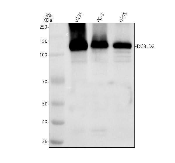 Anti-ENGASE Antibody Picoband® Boster Bio