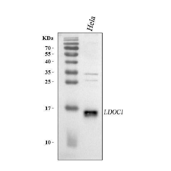 Anti-LDOC1 Antibody Picoband® Boster Bio