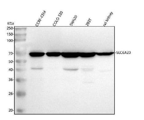 Anti-SLC6A20 Antibody Picoband® Boster Bio
