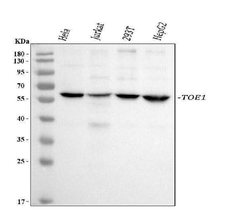 Anti-TOE1 Antibody Picoband® Boster Bio