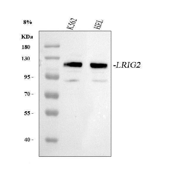 Anti-LRIG2 Antibody Picoband® Boster Bio