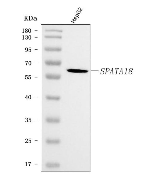 Anti-SPATA18 Antibody Picoband® Boster Bio