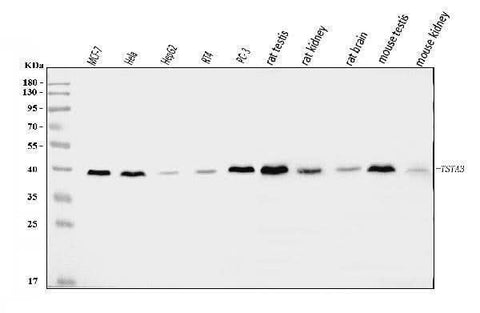 Anti-TSTA3/GFUS Antibody Picoband® Boster Bio