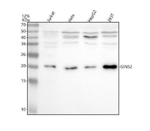 Anti-PSF2/GINS2 Antibody Picoband® Boster Bio