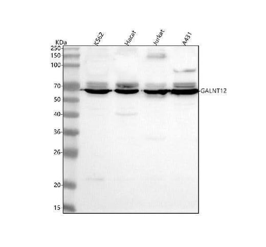 Anti-GALNT12 Antibody Picoband® Boster Bio