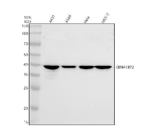 Anti-ENPP7 Antibody Picoband® Boster Bio
