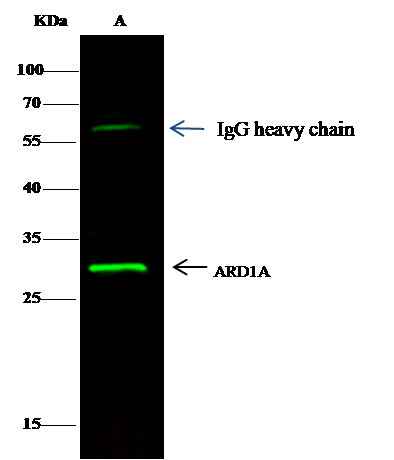 Anti-Human NAA10 Antibody [A1092] - ABMIUM