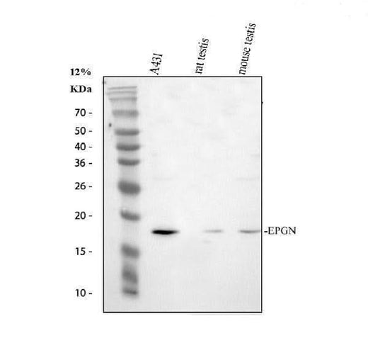 Anti-Epigen/EPGN Antibody Picoband® Boster Bio