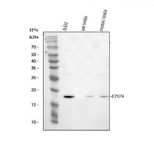 Anti-Epigen/EPGN Antibody Picoband® Boster Bio