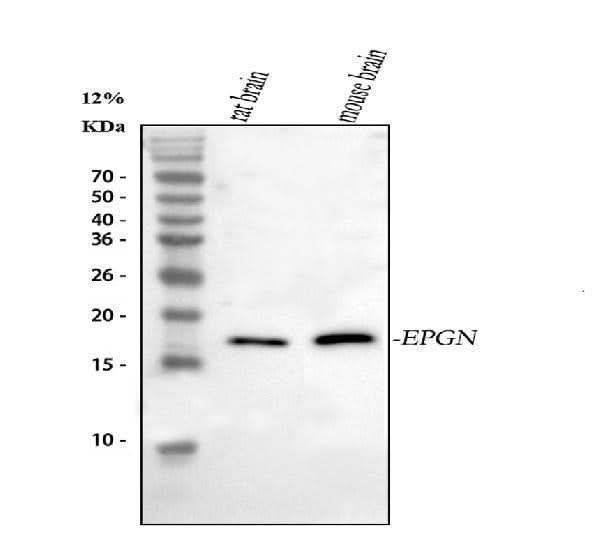 Anti-Epigen/Epgn Antibody Picoband® Boster Bio