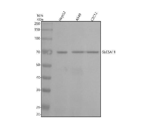 Anti-SLC5A11 Antibody Picoband® Boster Bio