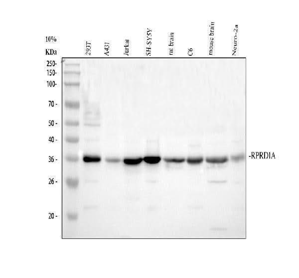 Anti-P15RS/RPRD1A Antibody Picoband® Boster Bio