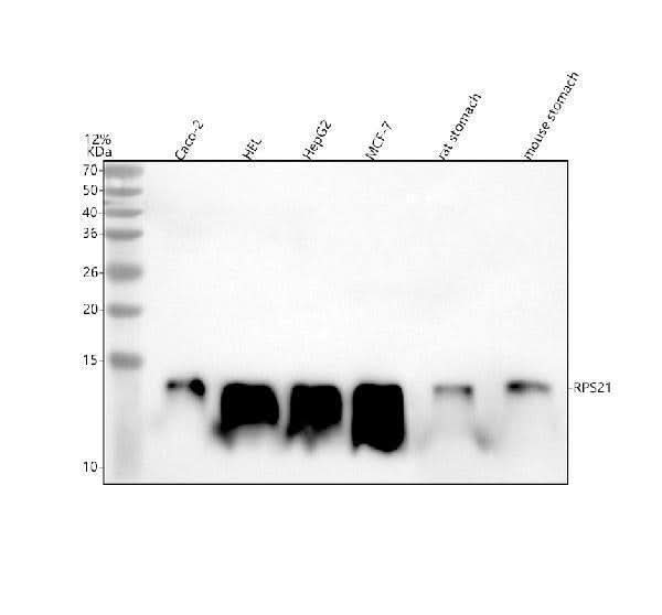 Anti-RPS21 Antibody Picoband® Boster Bio