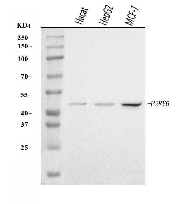 Anti-P2Y6/P2RY6 Antibody Picoband® Boster Bio