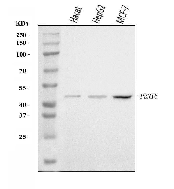 Anti-P2Y6/P2RY6 Antibody Picoband® Boster Bio